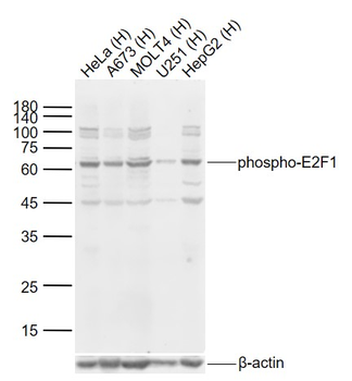 Phospho-E2F1 (Ser332) Rabbit Polyclonal Antibody