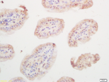 Phospho-E2F1 (Ser332) Rabbit Polyclonal Antibody