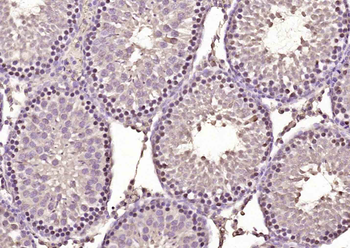 E2EPF Rabbit Polyclonal Antibody