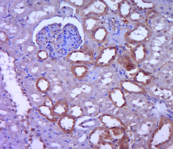 EHHADH Rabbit Polyclonal Antibody