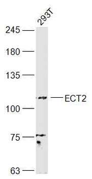 ECT2 Rabbit Polyclonal Antibody