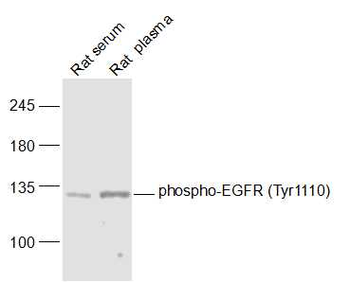 Phospho-EGFR (Tyr1110) Rabbit Polyclonal Antibody