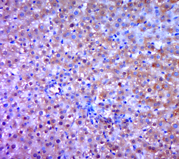 Phospho-EGFR (Tyr1197) Rabbit Polyclonal Antibody