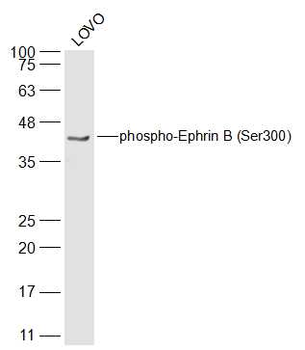 Phospho-Ephrin B (Ser300) Rabbit Polyclonal Antibody