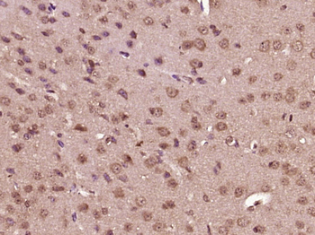 Phospho-MEK1 (Thr286) Rabbit Polyclonal Antibody