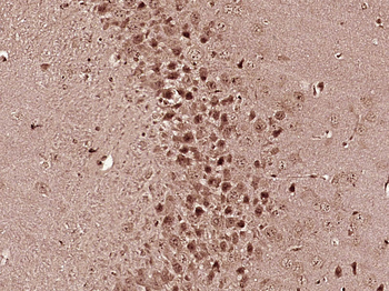 Phospho-MEK1 + MEK2 (Ser222) Rabbit Polyclonal Antibody