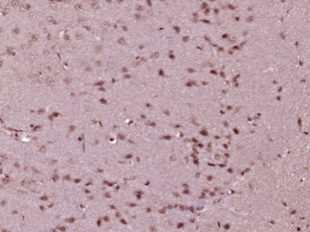 Phospho-MEK1 + MEK2 (Ser222) Rabbit Polyclonal Antibody