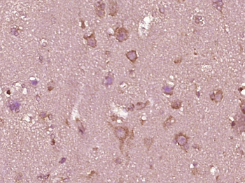 Phospho-MEK1 (Thr386) Rabbit Polyclonal Antibody