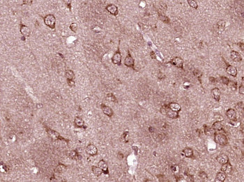 Phospho-MEK1 (Thr386) Rabbit Polyclonal Antibody