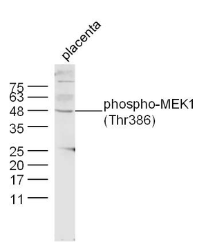 Phospho-MEK1 (Thr386) Rabbit Polyclonal Antibody