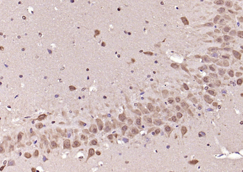 Phospho-ERK1/2 (Thr202 + Tyr204) Rabbit Polyclonal Antibody