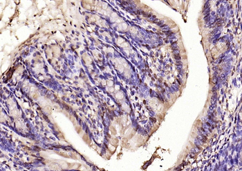 Phospho-ERK1/2 (Thr202 + Tyr204) Rabbit Polyclonal Antibody