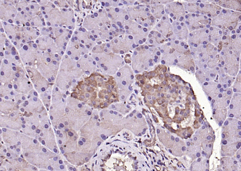 Phospho-ERK1/2 (Thr202 + Tyr204) Rabbit Polyclonal Antibody