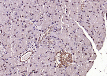 Phospho-ERK1/2 (Thr202 + Tyr204) Rabbit Polyclonal Antibody