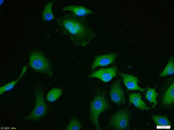 Phospho-ERK1/2 (Thr202 + Tyr204) Rabbit Polyclonal Antibody