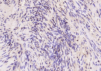 Phospho-ERK1/2 (Thr202 + Tyr204) Rabbit Polyclonal Antibody