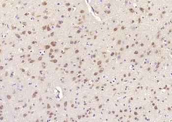 Phospho-ERK1/2 (Thr202 + Tyr204) Rabbit Polyclonal Antibody