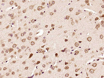 Phospho-ERK1/2 (Thr202 + Tyr204) Rabbit Polyclonal Antibody