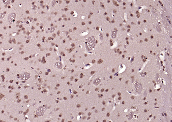 Phospho-ERK1/2 (Thr202 + Tyr204) Rabbit Polyclonal Antibody