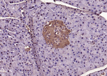 Phospho-ERK1/2 (Thr202 + Tyr204) Rabbit Polyclonal Antibody