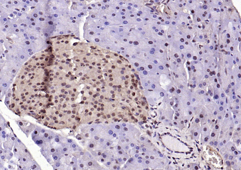 Phospho-ERK1/2 (Thr202 + Tyr204) Rabbit Polyclonal Antibody