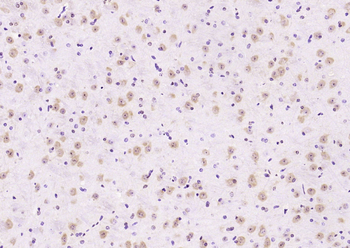 Phospho-ERK1/2 (Thr202 + Tyr204) Rabbit Polyclonal Antibody