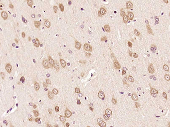 Phospho-ERK1/2 (Thr202 + Tyr204) Rabbit Polyclonal Antibody