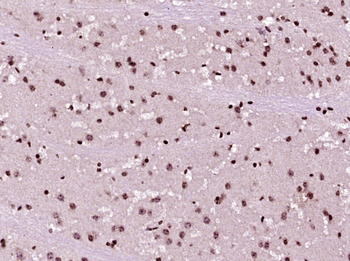 Phospho-MAPK3 (Tyr204) Rabbit Polyclonal Antibody