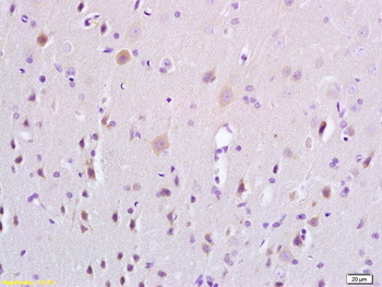 MAPK4 Rabbit Polyclonal Antibody