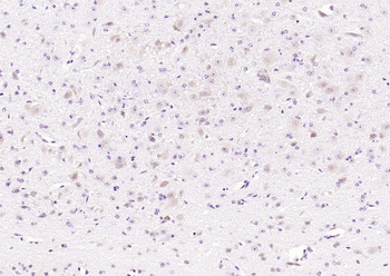 MAPK4 Rabbit Polyclonal Antibody