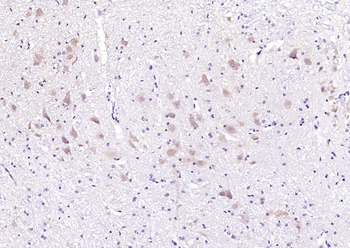 MAPK4 Rabbit Polyclonal Antibody