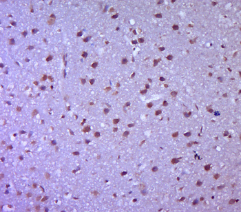 MAPK4 Rabbit Polyclonal Antibody