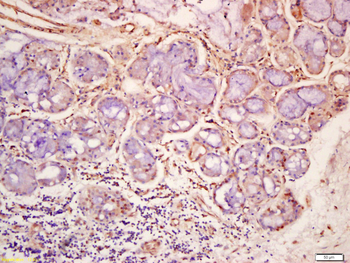 Phospho-ERK5 (Ser496) Rabbit Polyclonal Antibody