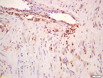 Phospho-ERK5 (Ser496) Rabbit Polyclonal Antibody