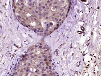 Phospho-ERK5 (Ser731+Thr733) Rabbit Polyclonal Antibody