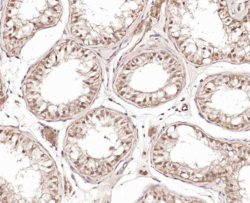 Phospho-ERK5 (Ser731+Thr733) Rabbit Polyclonal Antibody