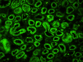 Phospho-ERK5 (Ser731+Thr733) Rabbit Polyclonal Antibody