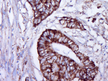 Phospho-Separase (Ser1073) Rabbit Polyclonal Antibody