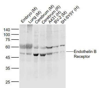 Endothelin B Receptor Rabbit Polyclonal Antibody