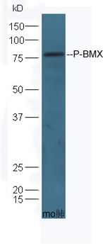 Phospho-BMX (Tyr566) Rabbit Polyclonal Antibody