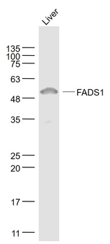 FADS1 Rabbit Polyclonal Antibody