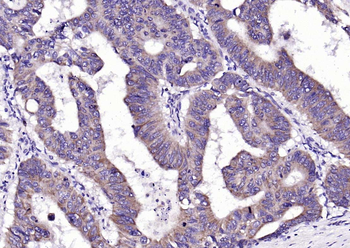 Phospho-FAK (Tyr861) Rabbit Polyclonal Antibody