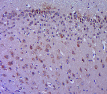 Phospho-FAK (Tyr861) Rabbit Polyclonal Antibody