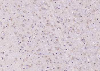 Phospho-FAK (Tyr861) Rabbit Polyclonal Antibody