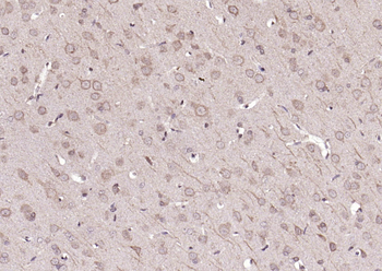 Phospho-FAK (Tyr861) Rabbit Polyclonal Antibody