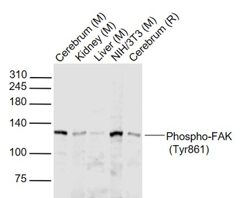 Phospho-FAK (Tyr861) Rabbit Polyclonal Antibody