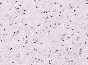 Phospho-FAK (Tyr576 + Tyr577) Rabbit Polyclonal Antibody