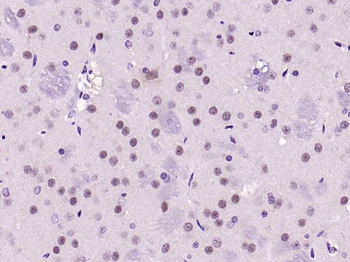 Phospho-FAK (Tyr576 + Tyr577) Rabbit Polyclonal Antibody