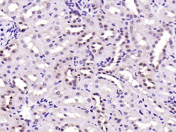 Phospho-FAK (Tyr576 + Tyr577) Rabbit Polyclonal Antibody
