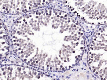 Phospho-FAK (Tyr576 + Tyr577) Rabbit Polyclonal Antibody